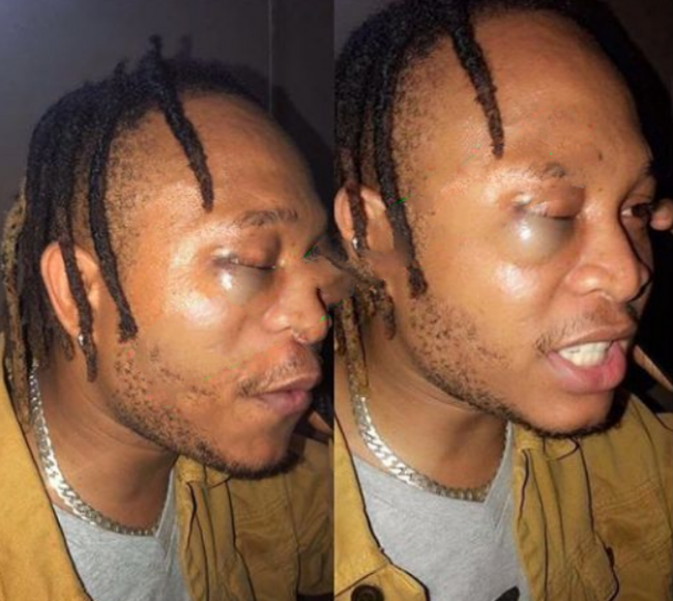 Former YBNL Singer, Viktoh Beaten By Police