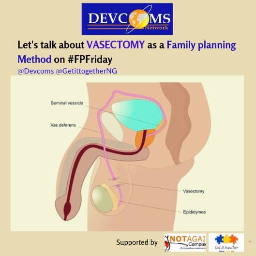 Things you need to know about Vasectomy