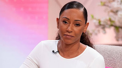 Mel B ‘doing fine after treating herpes eye infection’ that made her temporarily blind