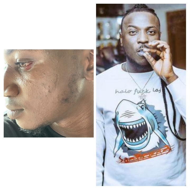 Peruzzi assaults & threatens social media influencer, Pamilerin Adegoke