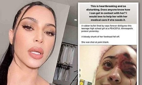 Kim Kardashian offers to pay medical bills of protester hit in face with rubber bullet
