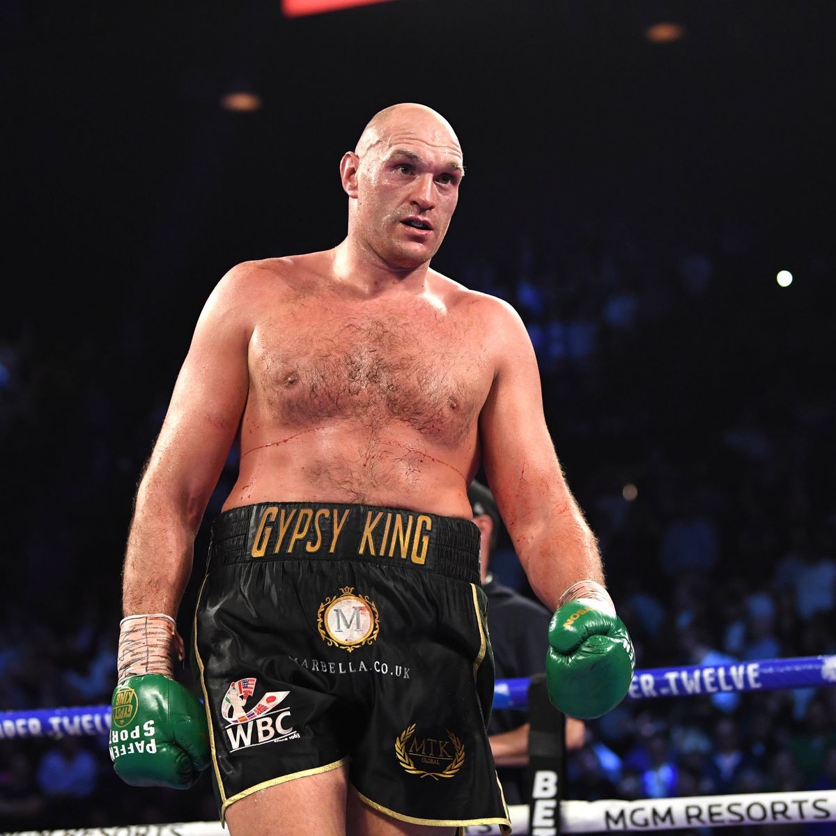 Tyson Fury rejects second Covid-19 jab due to concerns about sickness ahead of Deontay Wilder trilogy bout