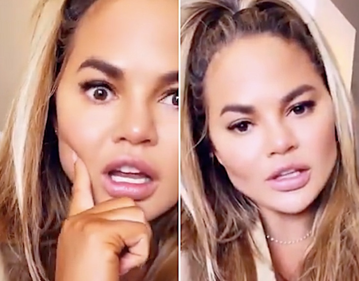 Chrissy Teigen reveals she had fat removed from her cheeks