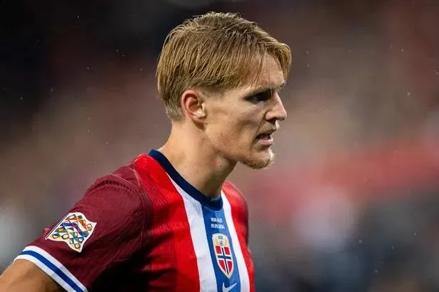 Martin Odegaard suffers injury blow ahead of Derby