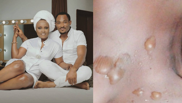 Blossom Chukwujekwu’s wife,took to Instagram to share a near-death experience she went through last week.