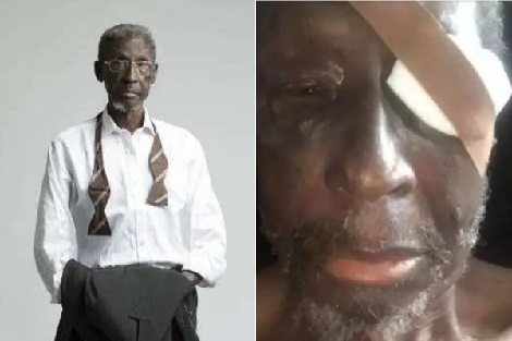 Sadiq Daba’s health worsens… about to lose his sight