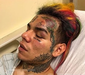 Overdose of diet pills, caffeine lands 6ix9ine in hospital