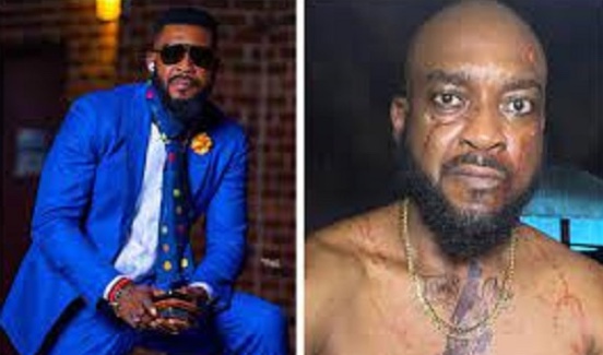 Bell’s Palsy Stopped Me From Acting – Chidi Mokeme