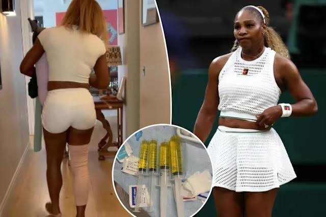 Injury ends Serena Williams’ Wimbledon comeback